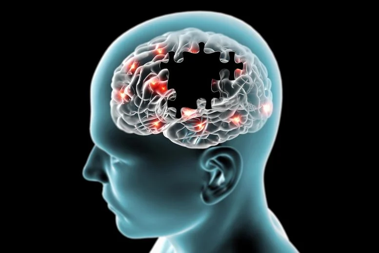 Scientists Discover How Obesity May Trigger Alzheimer’s Disease